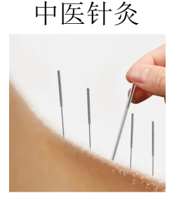 D.不锈钢针